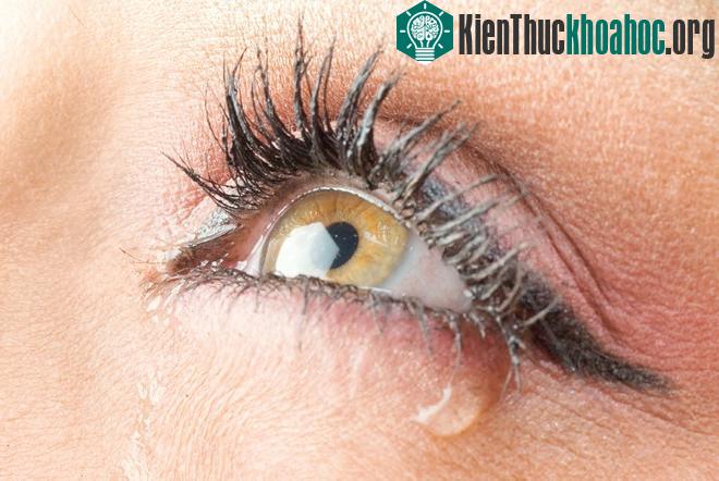 Chảy nước mắt không rõ lý do
