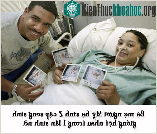 Mẹ sinh 2 cặp song sinh giống hệt nhau
