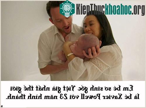 Thai nhi gốc Việt "già" nhất thế giới