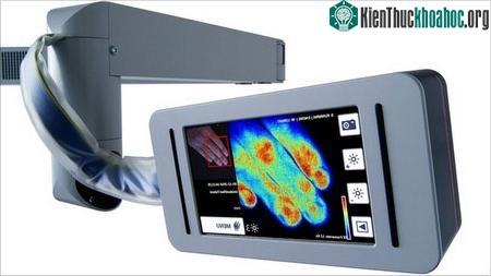 Thiết bị có tên “Hình ảnh Laser Doppler” có khả năng hiển thị lượng máu lưu thông trong da của những bệnh nhân bị bỏng (Ảnh: BBC)