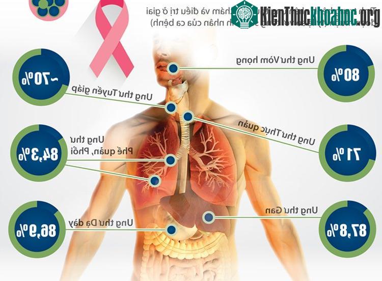 Người Việt thường để đến lúc bệnh ở giai đoạn nặng rồi mới đến viện kiểm tra.
