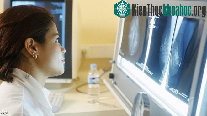 X-quang can thiệp cũng có thể giết chết tế bào ung thư hoặc làm khối u co lại.