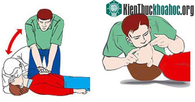 Kỹ thuật sơ cấp cứu