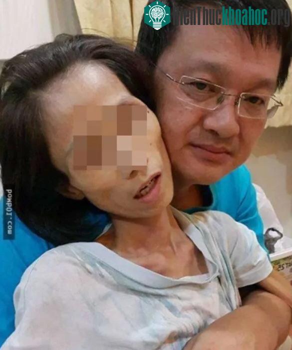 Người phụ nữ Malaysia được cho là mắc bệnh ung thư vì trong 10 năm ăn thức ăn thừa trong tủ lạnh.