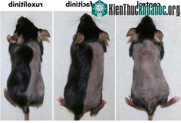 Tìm ra phương pháp đầy tiềm năng trong việc chữa chứng hói đầu ảnh 0