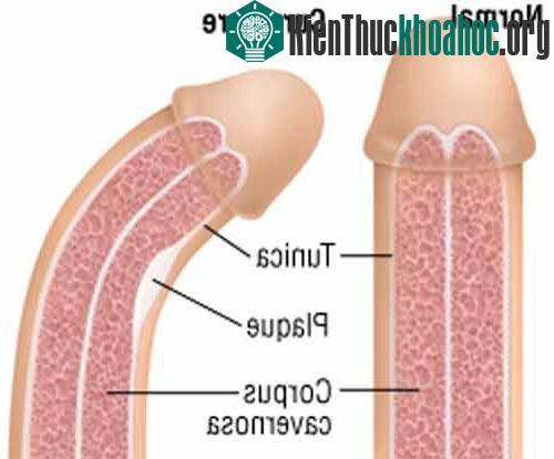 Những căn bệnh kỳ quái nhất thế giới