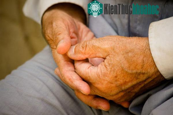 Alzheimer là một chứng bệnh suy giảm trí nhớ thường gặp - (Ảnh: Alamy).