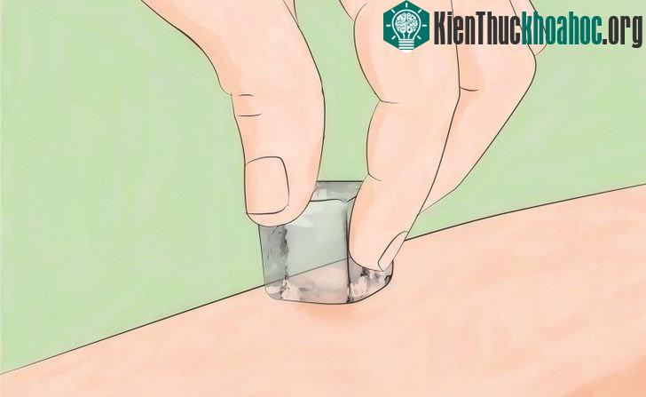 Một viên đá lạnh chà xát vào nốt muỗi đốt có thể phát huy tác dụng xoa dịu cơn ngứa.