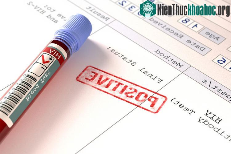 Những người nhiễm HIV ở Đan Mạch uống thuốc điều trị HIV đầy đủ, đó là lý do khiến việc điều trị phát huy tác dụng.