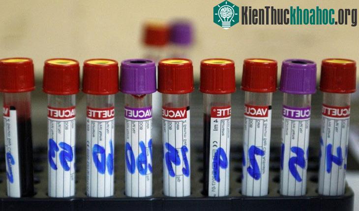 FDA đã thông qua một phương pháp phát hiện sớm Zika. (Ảnh: Reuters).