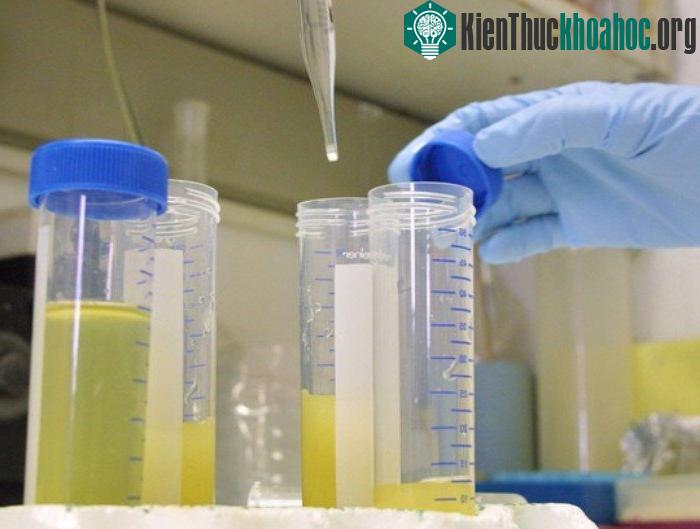 Nước tiểu có màu vàng nhạt không sao cả, đó là bởi vì có thể bạn đã uống khá nhiều nước trong một lần sử dụng