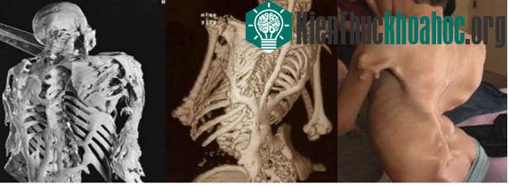 14 căn bệnh kỳ quái nhất thế giới