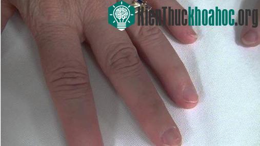 14 căn bệnh kỳ quái nhất thế giới