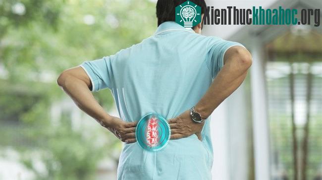 Đau lưng do vôi hóa cột sống