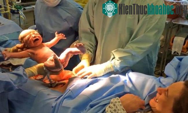 Khoảnh khắc em bé chào đời gây xúc động. (Ảnh: Youtube).