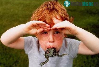 14 căn bệnh kỳ quái nhất thế giới
