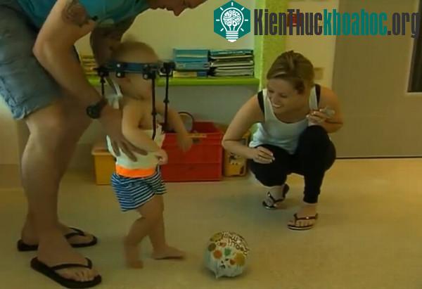 Jaxon phải đeo khung định vị hộp sọ trong tám tuần để cố định xương. (Ảnh:&nbsp;mirror).