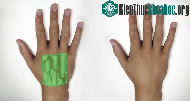 Với VeinViewer này, bạn sẽ được tiêm mà không bao giờ sợ nhầm nữa.