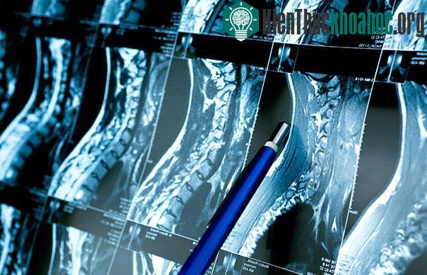 Tỉ lệ mắc ung thư hộp sọ và cột sống rất thấp và có từ khi người bệnh còn trong bụng mẹ.