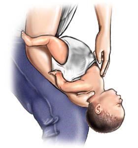 Trẻ bị mắc dị vật