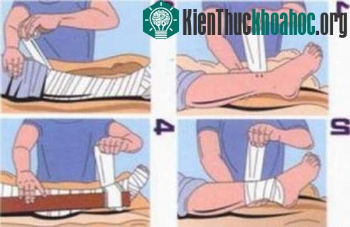 Đây là hình ảnh sơ cứu của ép bất động. Biện pháp này không được dùng khi bị rắn lục cắn.