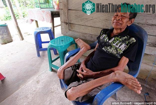 Những người sống cùng làng rất thán phục khả năng của người đàn ông được mệnh danh là “người cao su”.