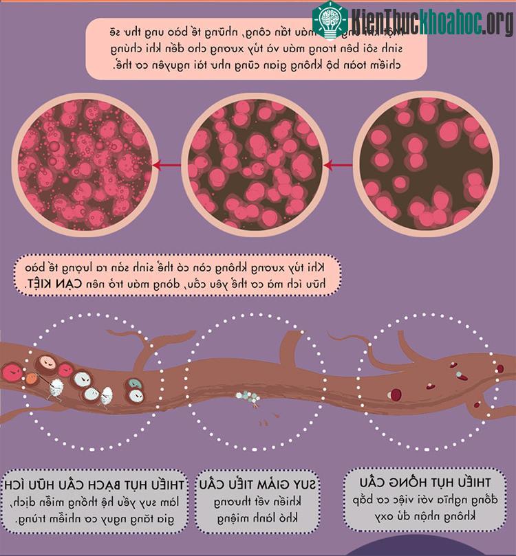 Khi tủy xương khoog thể sinh sản ra lượng tế bào hữu ích mà cơ thể yêu cầu, dòng máu sẽ trở nên cạn kiệt.