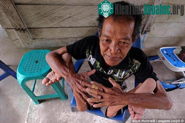 Ông Bejan ngôi trên ghế trong khi hai bàn chân được gập ngược gần tới vai.