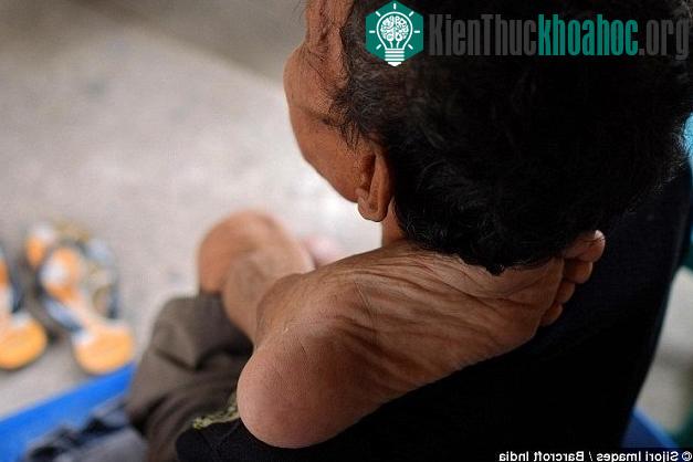 Ông Bejan thậm chí có khả năng đưa chân lên tận cổ mà không hề cảm thấy đau đớn.