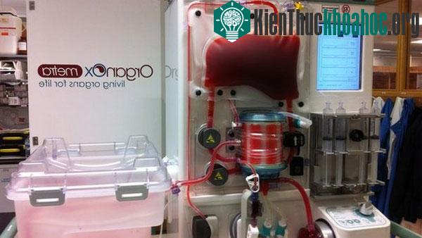 Hệ thống bảo quản tim Organ Care