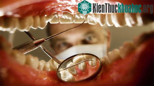 Bao lâu chúng ta nên đi khám răng một lần?