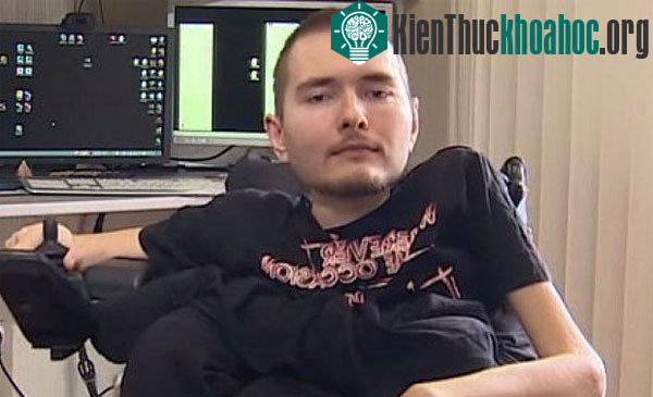 Valery Spiridonov, kỹ sư người Nga, tình nguyện là bệnh nhân đầu tiên được cấy ghép đầu. (Ảnh: Telegraph).