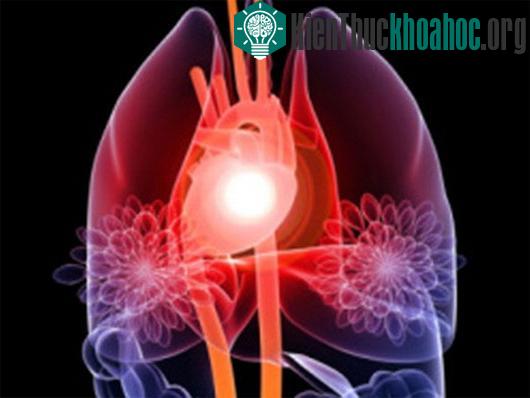 Ảnh minh họa: scitechdaily.com