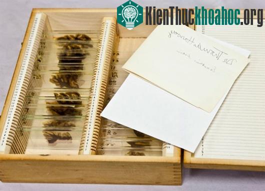 Chiếc hộp chứa 42 mẩu não của Einstein tại Philadenphia vào năm 2011​