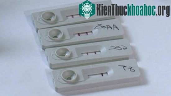 Thiết bị xét nghiệm nhanh bệnh phong