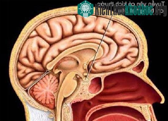 Các căn bệnh "triệu người mắc một" giống Wanbi Tuấn Anh trên thế giới