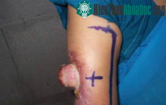 Các căn bệnh "triệu người mắc một" giống Wanbi Tuấn Anh trên thế giới