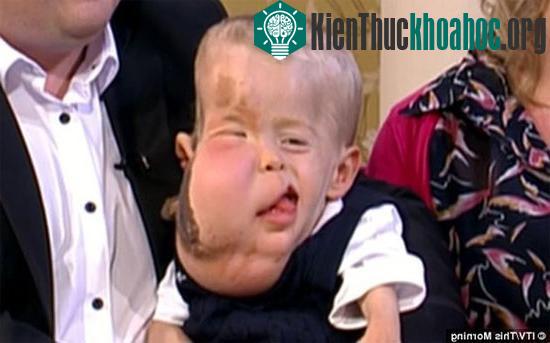 Cậu bé Aidan Jackoviak Smith không may mắc chứng bệnh lạ.