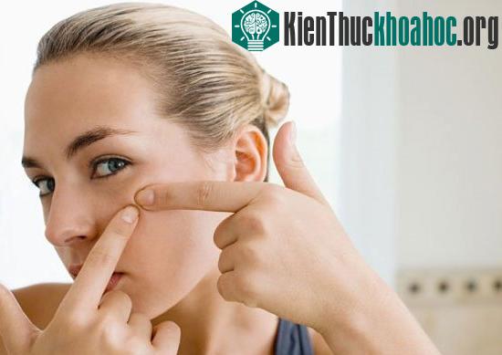 Hơn 85% thiếu niên và trên 40 triệu người Mỹ bị mụn trứng cá.&nbsp;