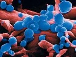 Gia cầm biến đổi gen không truyền virus cúm H5N1 ảnh 0