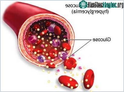 Úc: cấy ghép tế bào tạo insulin cho bệnh nhân tiểu đường type I ảnh 0