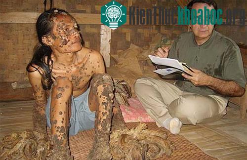 Tiến sĩ Gaspari tình nguyện chữa bệnh cho Dede