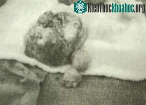 Những ca phẫu thuật hy hữu ảnh 0