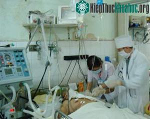 Đột quỵ, bệnh hiểm thứ hai sau chấn thương sọ não ảnh 0