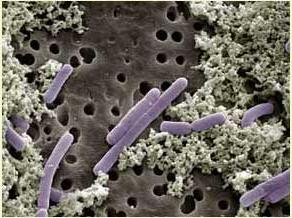 Vi khuẩn Lactobacillus casei