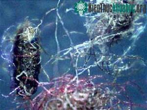 Sợi Morgellons