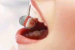 Điều trị chủ yếu là vệ sinh răng miệng đúng cách (đánh răng bằng bàn chải và bằng chỉ nha khoa) có thể giải quyết tốt bệnh.