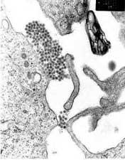 Virus Dengue nhìn qua kính hiển vi điện tử