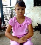 Vết bầm trên da ảnh 0