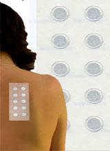 Patch Test: Xét nghiệm tìm nguyên nhân gây dị ứng ảnh 0